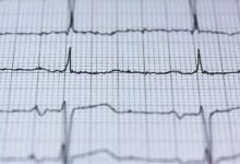 cyber node stellar pulse